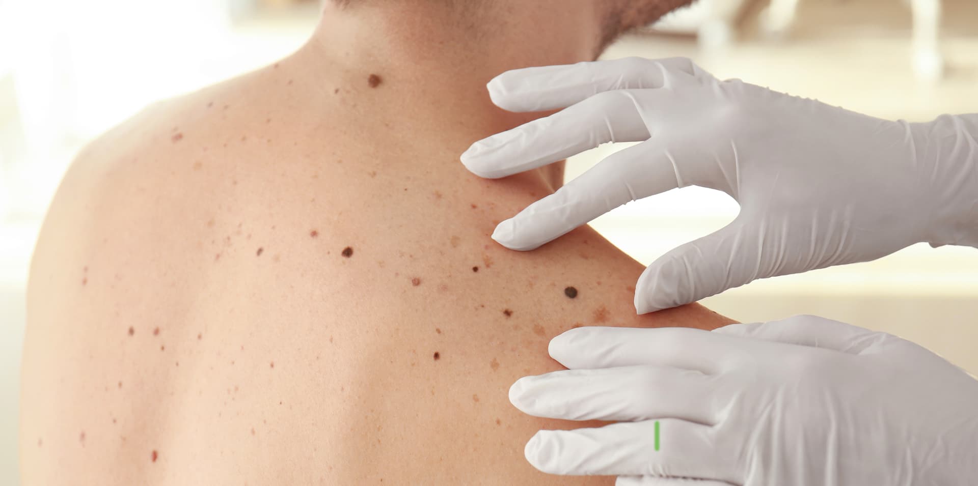 Dermatologiya